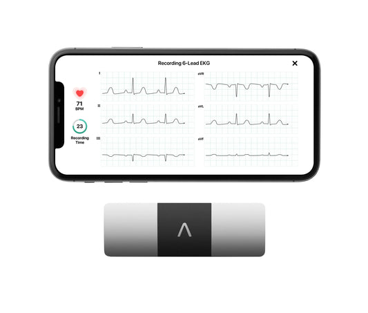 KardiaMobile 6L Personal EKG Monitor with Most Smartphones